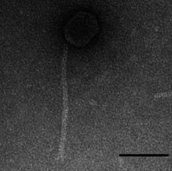 electron microscope image of a bacteriophage